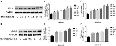 Galectin-3 Mediates Thrombin-Induced Vascular Smooth Muscle Cell Migration